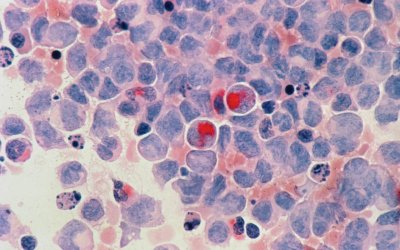 Can Smoking Meat Cause Cancer? Understanding the Risks and How to Mitigate Them